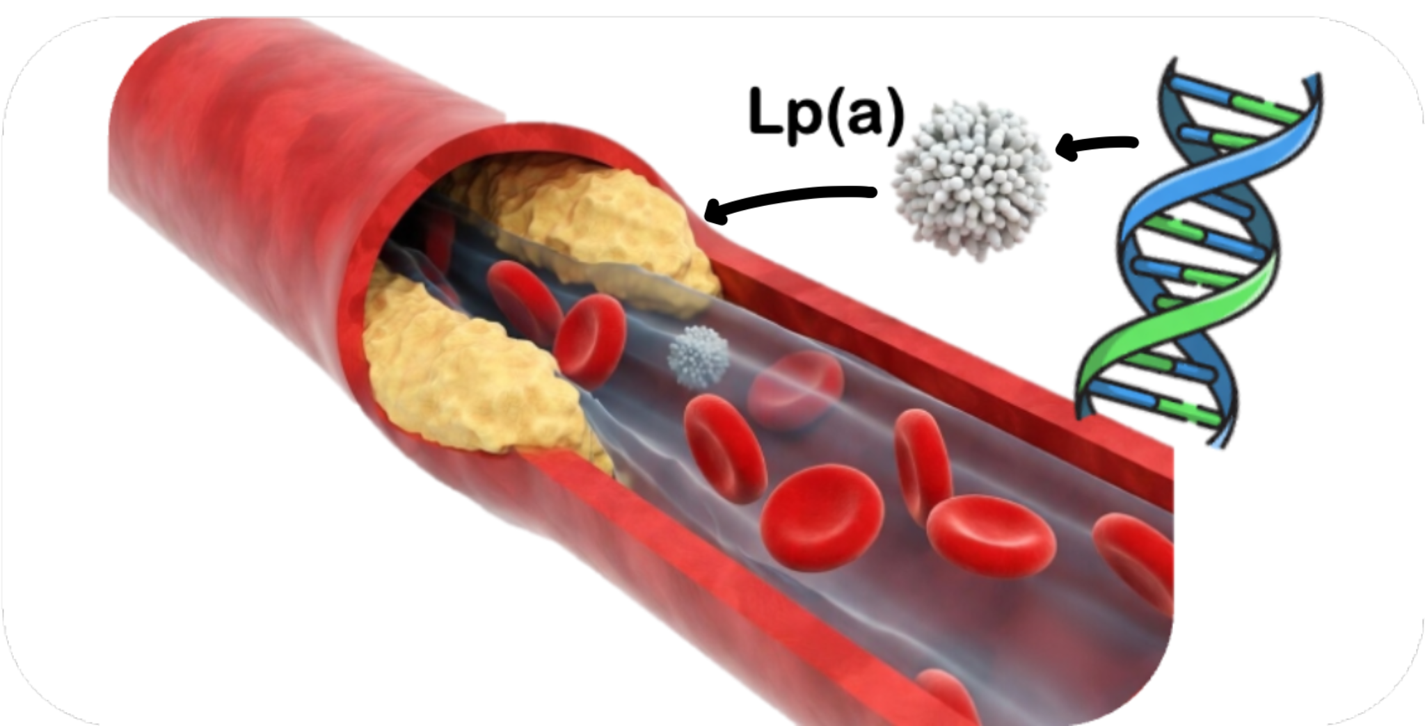 lipoprotein (a)